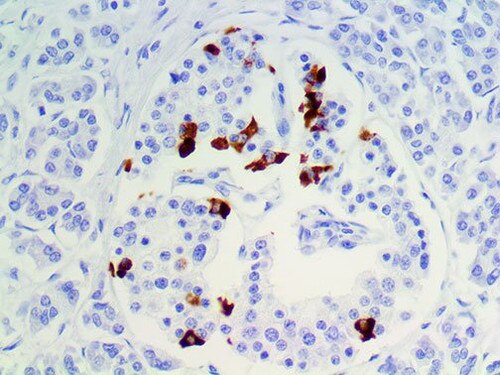 IHC of Somatostatin on a FFPE Pancreas Tissue